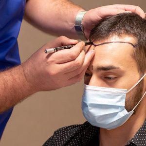 It's Not Just a Hair Transplant, It's An Experience!