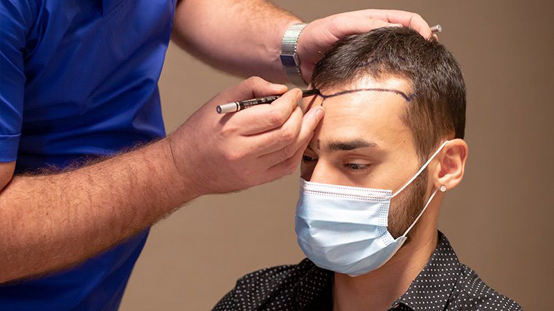 It's Not Just a Hair Transplant, It's An Experience!